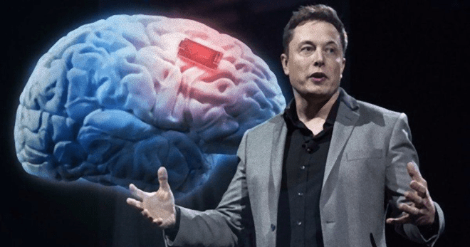 Το Neuralink του Musk έχει ευρύτερους στόχους για τσιπάκια στον εγκέφαλο όλων των ανθρώπων, «ηθική ανησυχία» εκφράζουν οι ειδικοί.